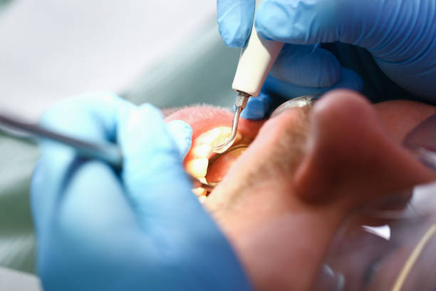 Best Cracked Tooth Emergency Dentist  in River Ridge, FL